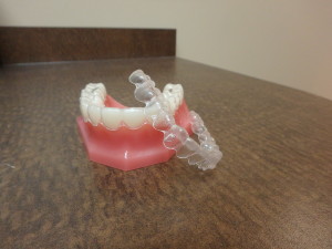 Invisalign