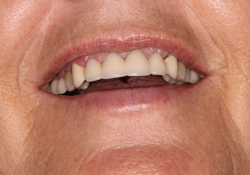 IMG_0861 Patient Image #2