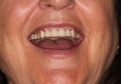 IMG_0865 Patient Image #3